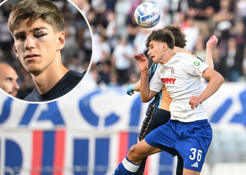 Problem za Hajduk; ozlijedio se stoper koji je trebao startati protiv Zire