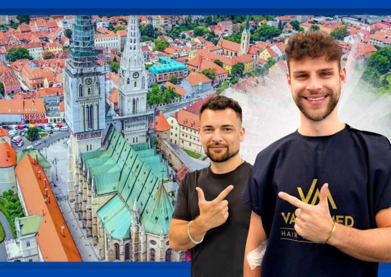 Recite zbogom ćelavosti: VatanMed je spremio novo iznenađenje