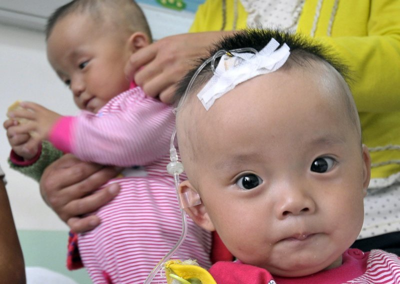 U Kini gotovo tisuću djece otrovano olovom