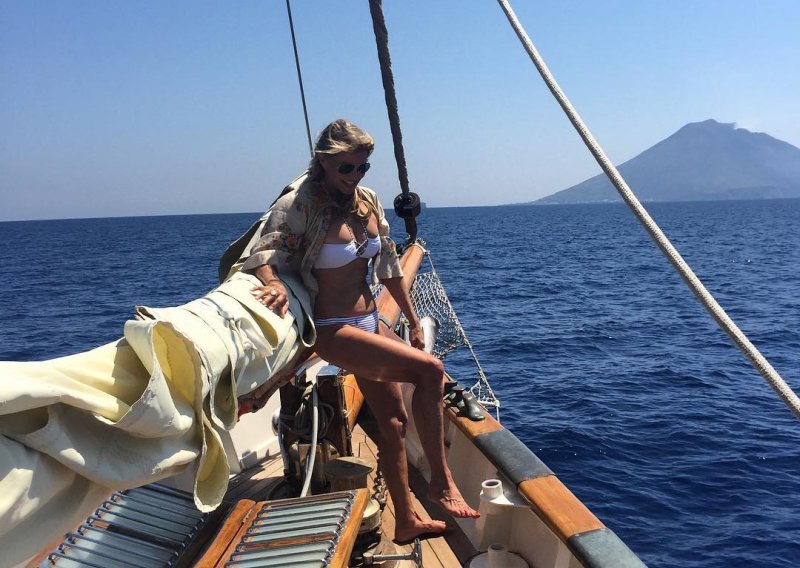 Christie Brinkley otvoreno o tome zašto ne voli botoks