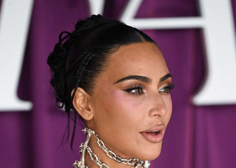 Liječnici Kim Kardashian otkrili aneurizmu u mozgu, ona za sve okrivila Kanye Westa