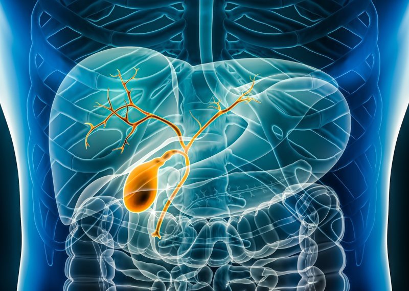 Brzo rješenje za žučne kamence: operacija bez straha, povratak svakodnevici unutar tjedan dana