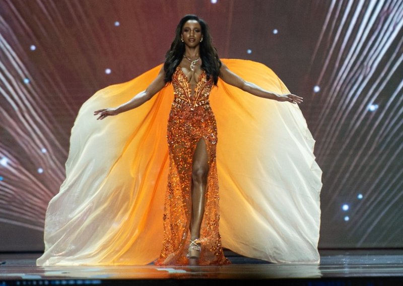 Miss Jamajke je na intenzivnoj njezi: Pad s pozornice ozbiljniji nego što se mislilo