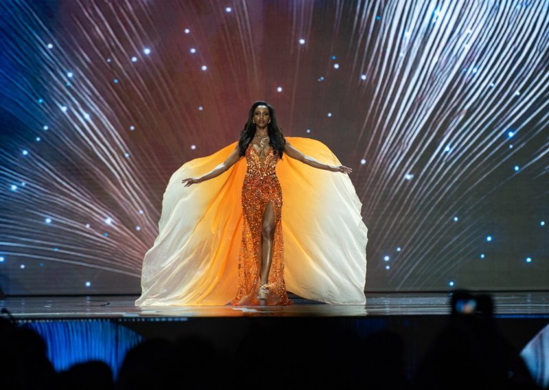 Objavljeni novi detalji o zdravstvenom stanju Miss Jamajke