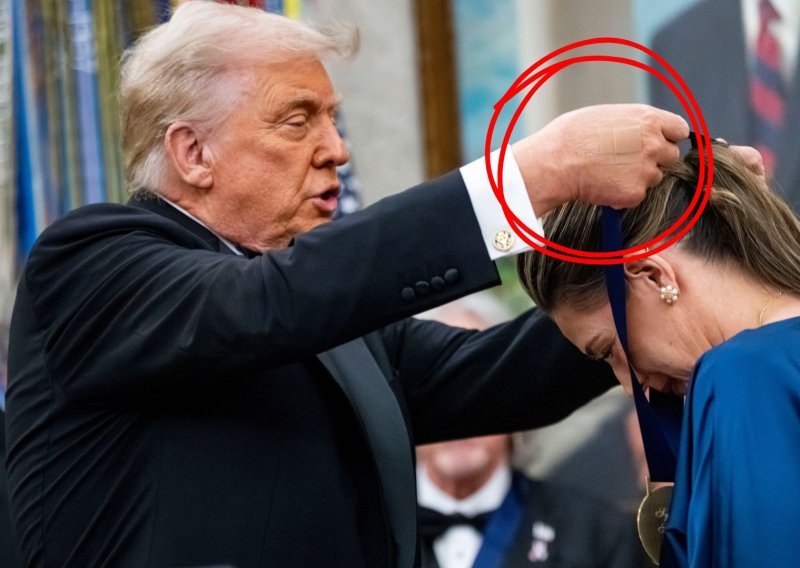 Bijela kuća konačno otkrila zašto Trump ima flastere po rukama, a objašnjenje je prilično bizarno