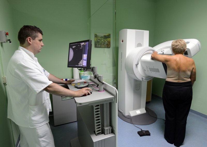 Odaziv na mamogarafiju je visokih 70 posto, ali cilj je još viši