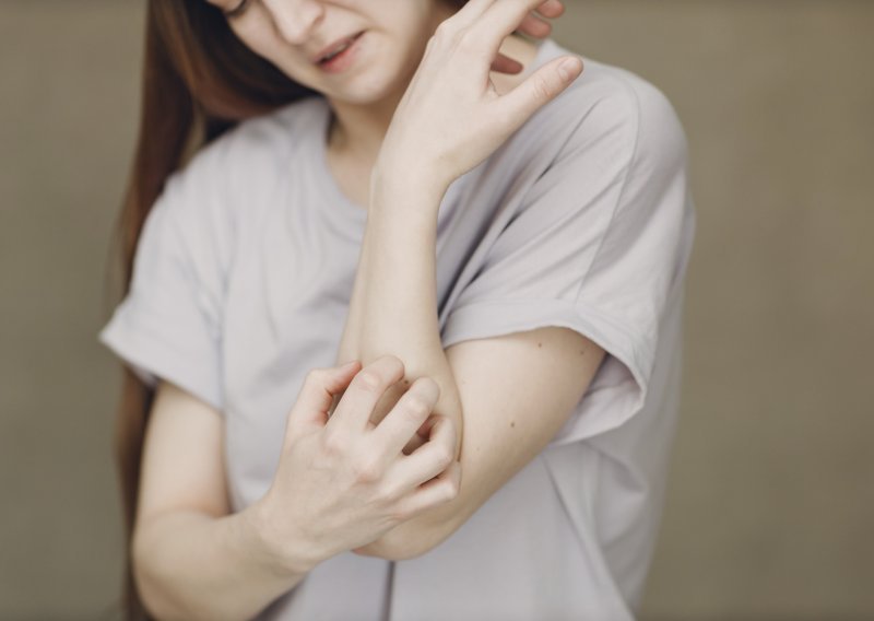 U Dubrovniku se pojavila šuga, evo koji su simptomi i kako se liječi