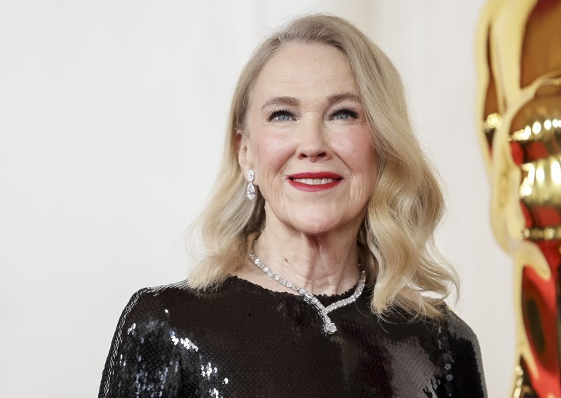 Nije imala pojma da je drukčija: Catherine O'Hara imala je rijetko stanje koje pogađa jednu od 10.000 osoba