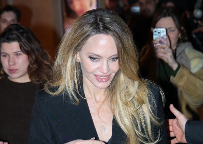 Za hrabro priznanje Angeline Jolie mnogi nemaju snage, ali ni želudca