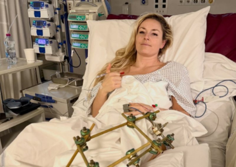 Lindsey Vonn objavila prvu fotografiju nakon stravične nesreće na Igrama