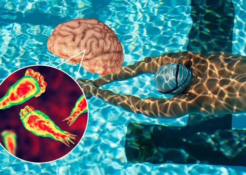 Uzbuna zbog rastuće globalne prijetnje: U vodi vreba ameba koja jede mozak