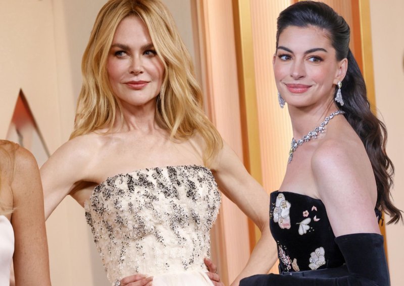 Mislili ste da su to samo dobri geni? Kirurzi otkrili zašto sve slavne glumice izgledaju isto