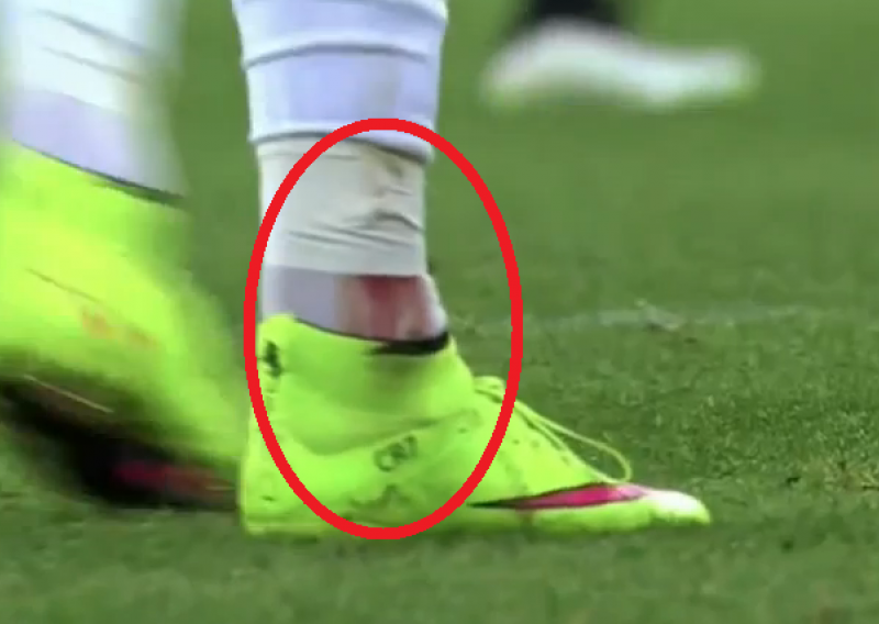 Ronaldova krvava čarapa izazvala je burne reakcije