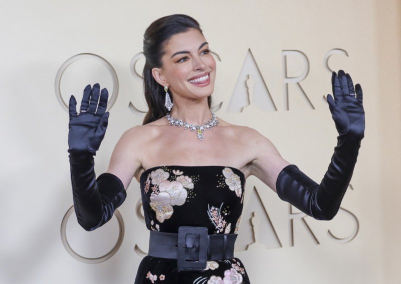 Domaći estetski stručnjak o Anne Hathaway: Što mogu nekirurški tretmani kad se rade pametno