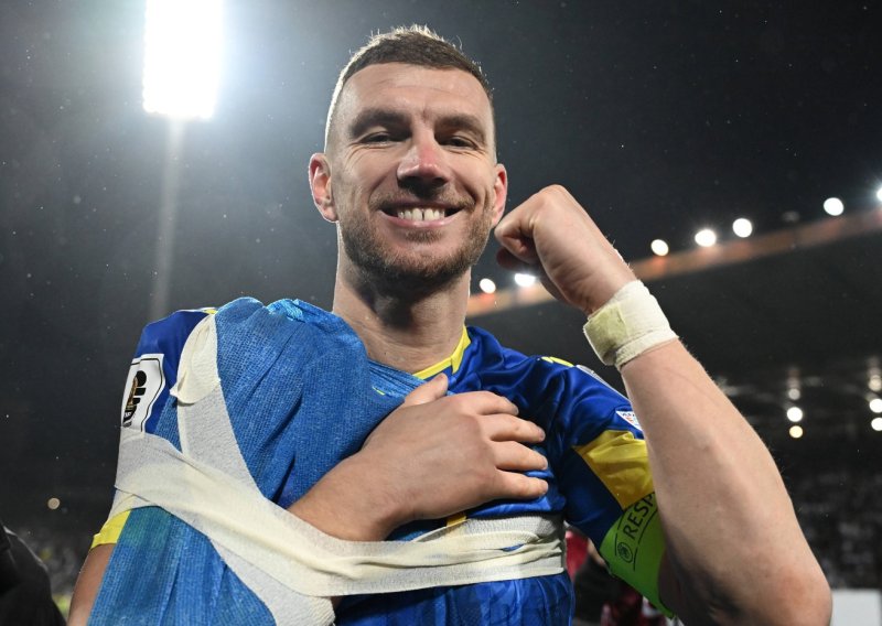 Edin Džeko se oglasio i otkrio koliko je teška njegova ozljeda