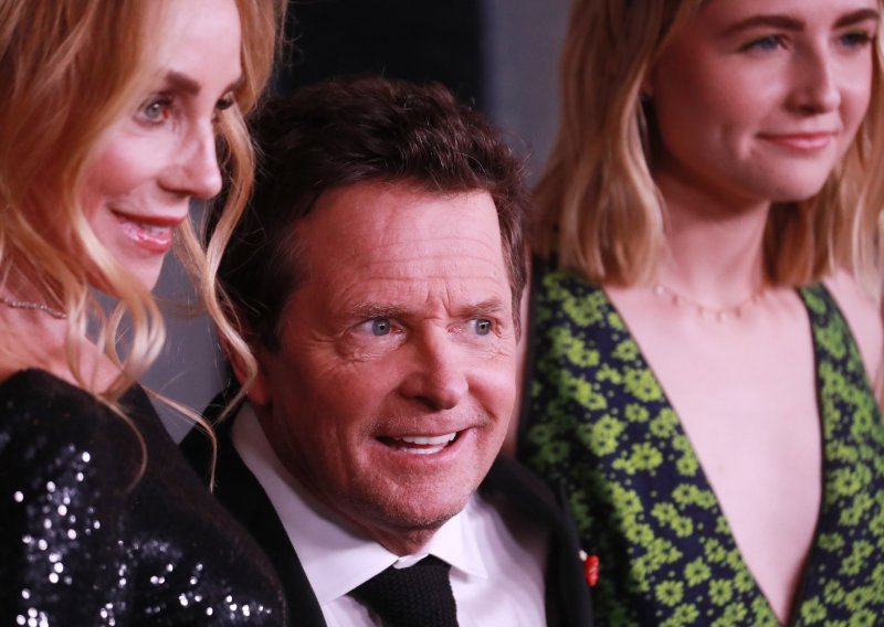 Ovim holivudskim zvijezdama dijagnosticirana je Parkinsonova bolest, evo kako im je mijenjala život