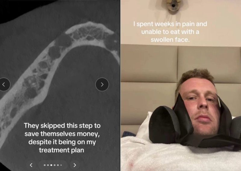 U Tursku otišao popraviti zube: Na kraju je ostao bez ijednog