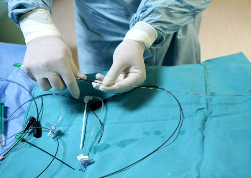 Zbog bolova završio u bolnici, liječnici u šoku: Evo što je nosio u sebi 20 godina