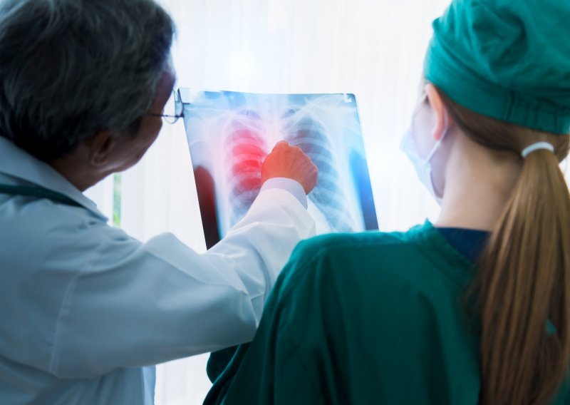 Golem proboj u liječenju raka pluća: 'Nikad nismo bili bliže rješenju'