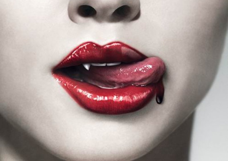 'Vampirskom' terapijom riješite se akni