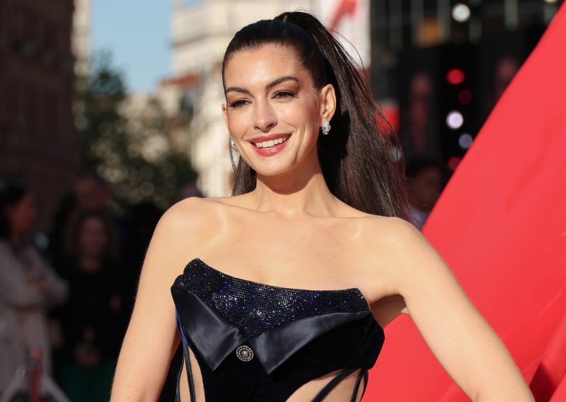 'Besplatan facelift' je genijalan trik Anne Hathaway za mladolik izgled, ali krije opasnost