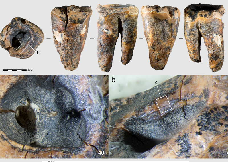 Znanstvenici imaju dokaze: Neandertalci su prije 59 tisuća godina imali - zubare