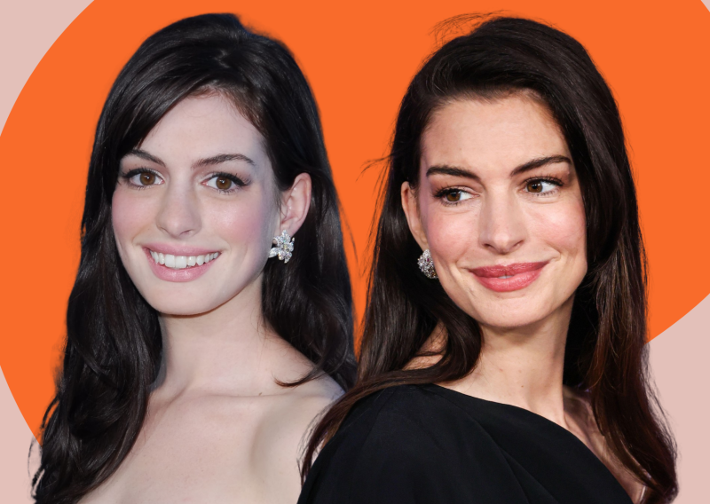 Anne Hathaway o estetskim zahvatima: 'Ljudi su uvjereni da znaju istinu o mom licu'