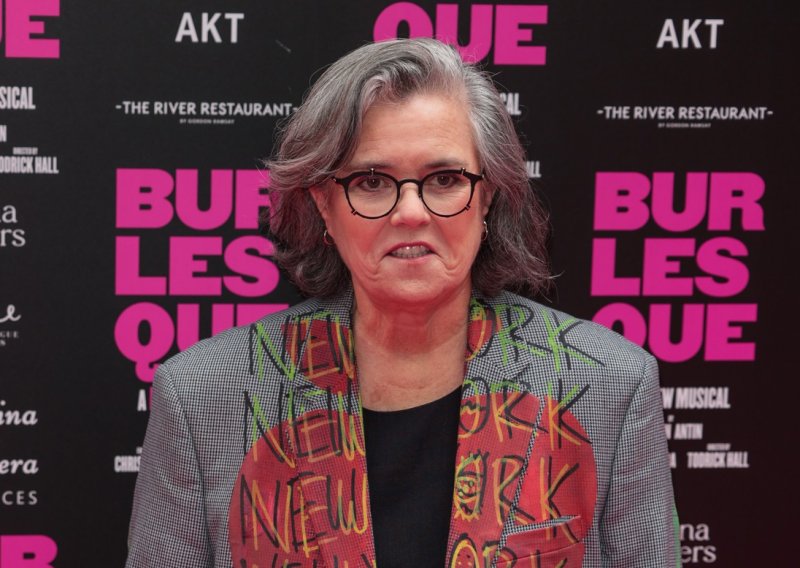 Platila je više nego za auto: Rosie O'Donnell progovorila o tajnom estetskom zahvatu