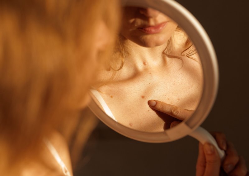 Znanstvenici s Ruđera došli do važnog otkrića o širenju melanoma