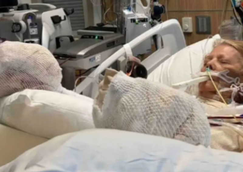 Žena zaspala na bazenu za vrijeme sunčanja: Zatajili joj organi, opečena je do kosti