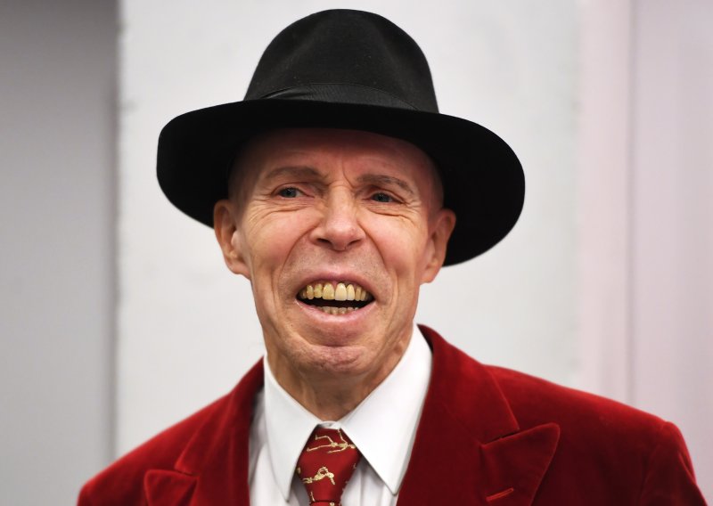 Preminuo Gunther von Hagens, kontroverzni anatom poznat kao 'Doktor Smrt'. Njegovo tijelo bit će plastinirano