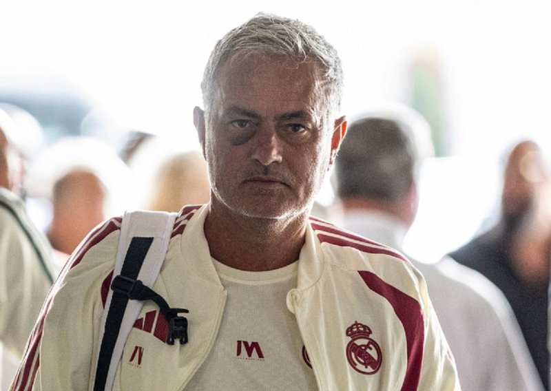 Jose Mourinho šokirao izgledom: Velika modrica ispod oka zabrinula je sve