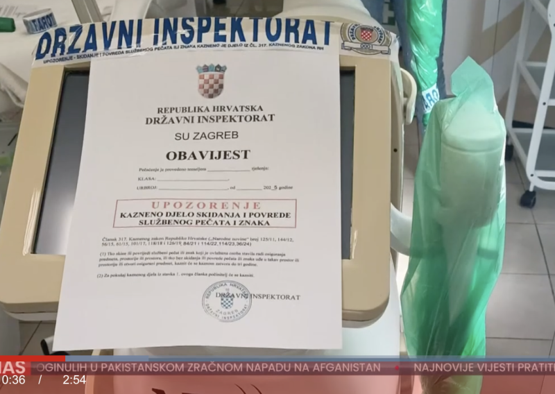 Opasni propusti u domaćim salonima za uklanjanje dlačica: Riskiraju opekline i sljepoću