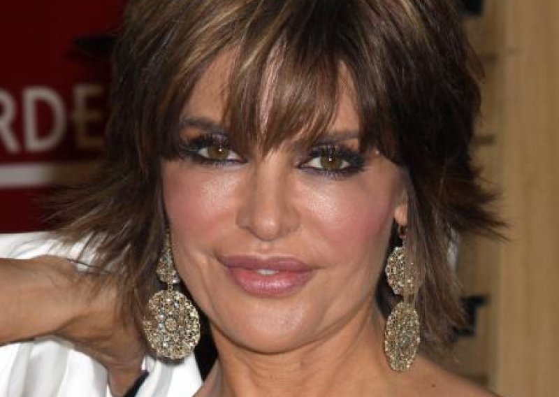 Lisa Rinna strahuje da će joj usne eksplodirati