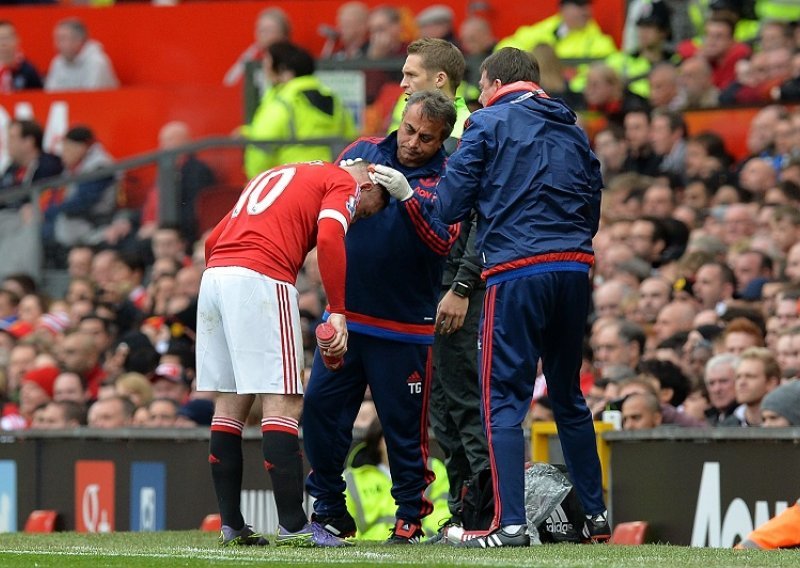 Rooney krvave glave iz slabog mančesterskog derbija