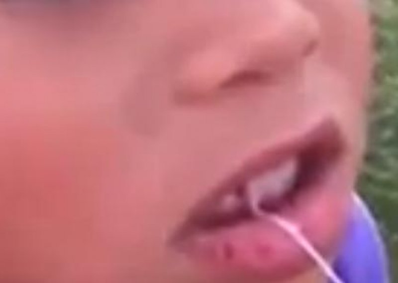 Ovako olimpijski pobjednik vadi dječje zubiće...