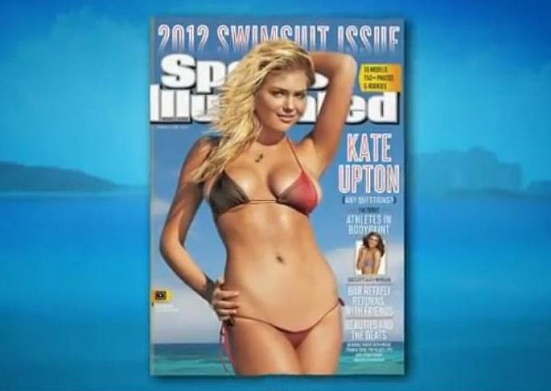 Kate Upton dobila promrzline na Antarktiku