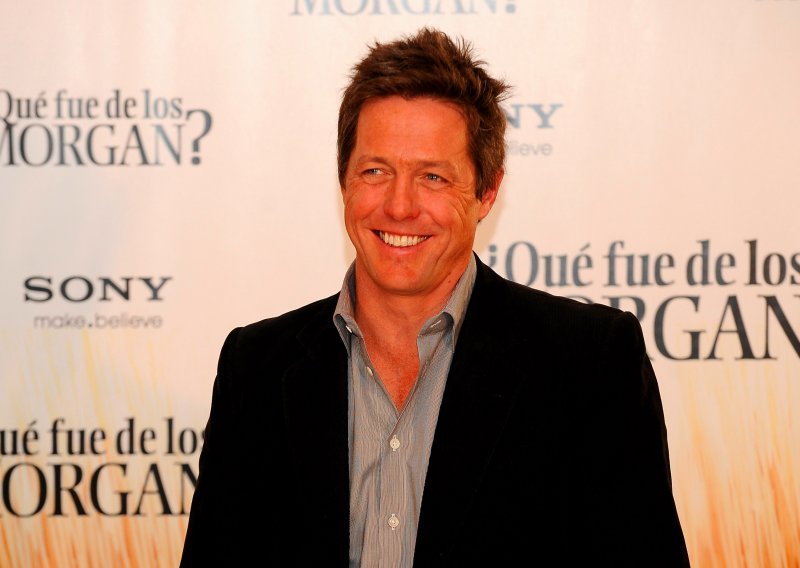 Hugh Grant izgorio u solariju