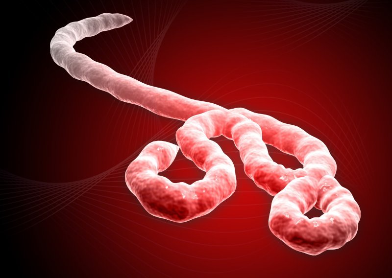 Zbog ebole 18 osoba stavljeno pod nadzor