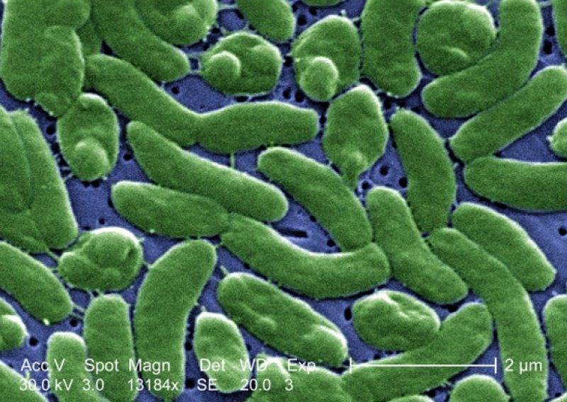 Bakterije mesožderke ubijaju kupače na Floridi