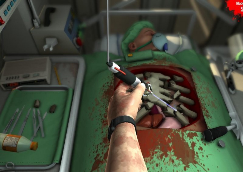 iPad verzija Surgeon Simulatora krcata je presmiješnim bugovima