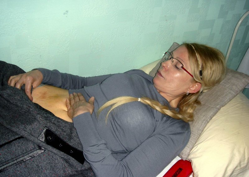 Izgladnjelu Timošenko prebacuju u bolnicu