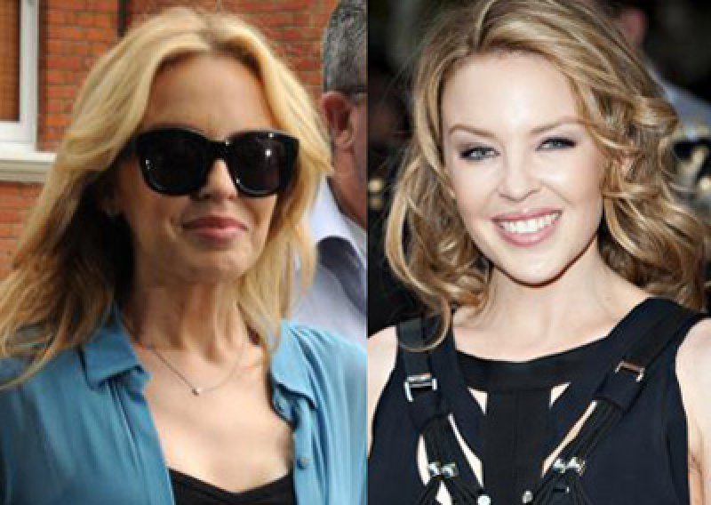 Kylie Minogue dokazala da je lijepa i bez botoksa
