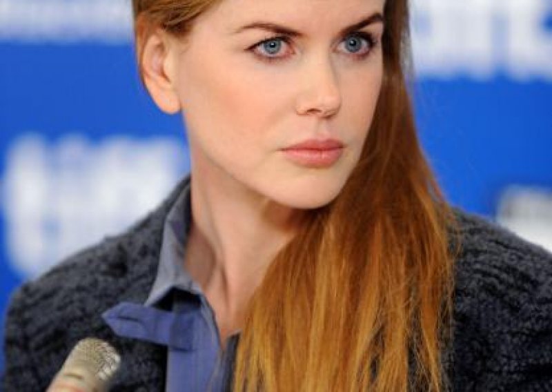 Lice Nicole Kidman zamrznuto botoksom
