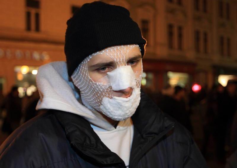 Three people injured in Thursday's demonstrations in Zagreb