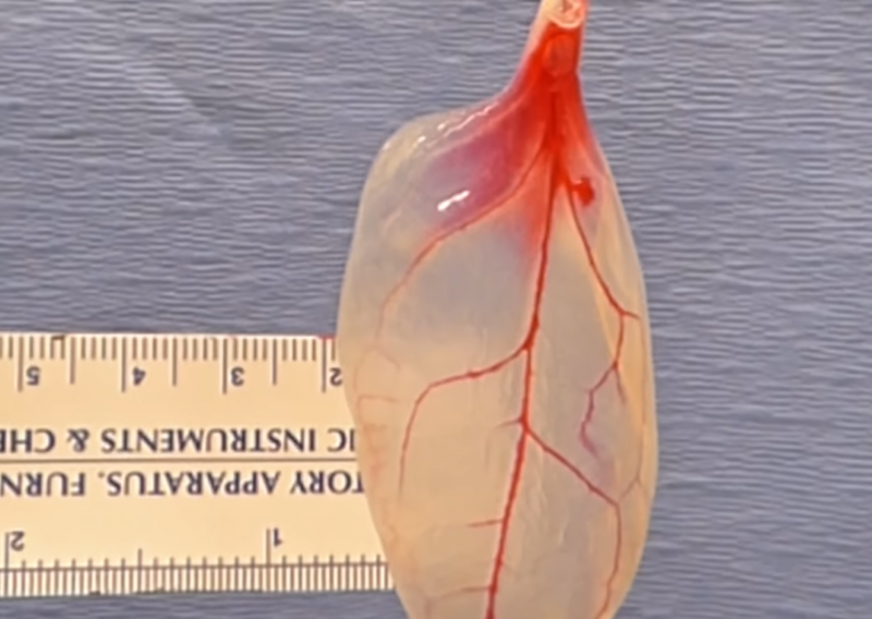 Od lista špinata s tržnice moguće je napraviti potpuno funkcionalno srčano tkivo!
