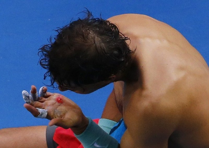 Nadal pobjedu protiv Nishikorija platio 'krvlju'