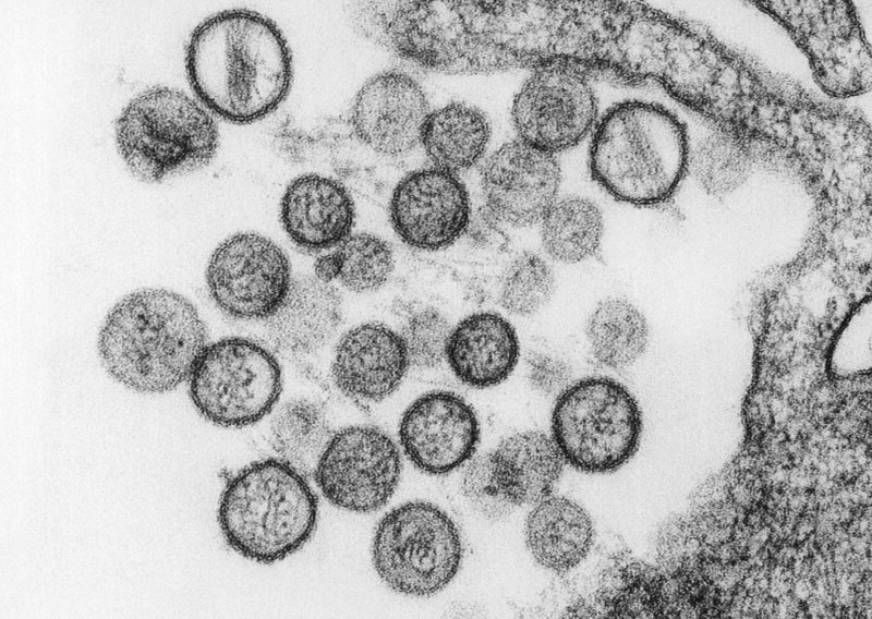 Hantavirus hara Kalifornijom, troje mrtvih