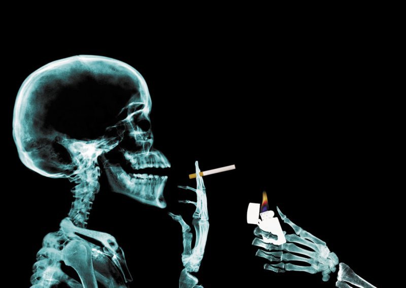 Žuti zubi i tumor pluća na kutijama cigareta