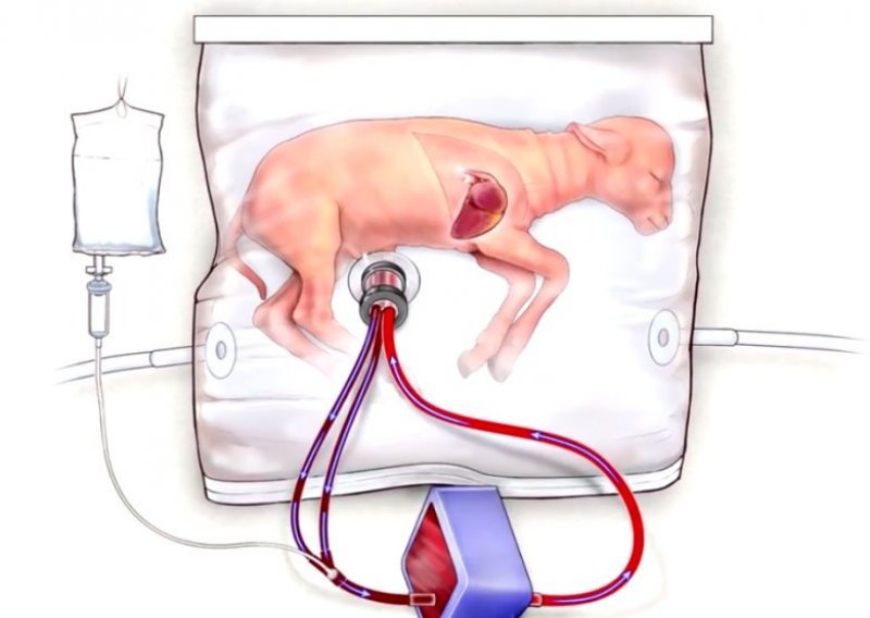 Ova umjetna maternica mogla bi spašavati živote nedonoščadi